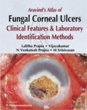 Aravind'S Atlas Of Fungal Corneal Ulcers
