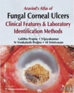 Bertrand.pt - Aravind'S Atlas Of Fungal Corneal Ulcers