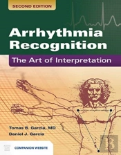 Arrhythmia Recognition: The Art Of Interpretation