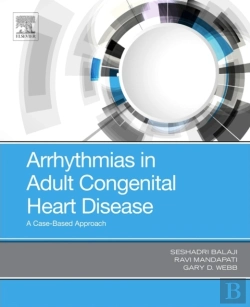 Bertrand.pt - Arrhythmias In Adult Congenital Heart Disease