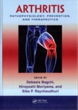 Bertrand.pt - Arthritis