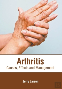 Bertrand.pt - Arthritis
