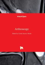 Arthroscopy