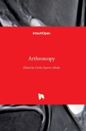Arthroscopy