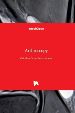 Bertrand.pt - Arthroscopy