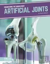 Artificial Joints
