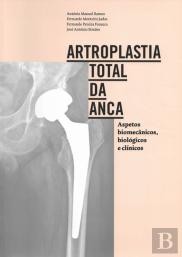 Artroplastia Total da Anca