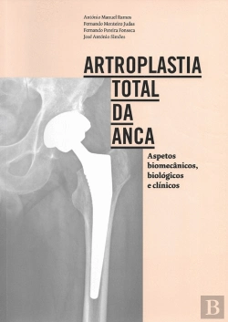 Bertrand.pt - Artroplastia Total da Anca