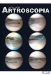 Artroscopia