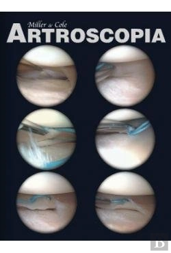 Bertrand.pt - Artroscopia Flexilibro