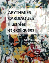 Arythmies Cardiaques Illustrees Et Expliquees