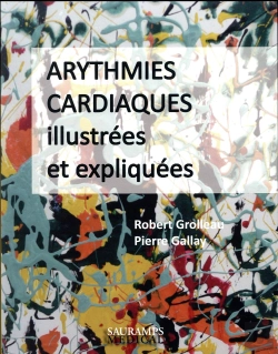 Bertrand.pt - Arythmies Cardiaques Illustrees Et Expliquees