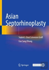 Asian Septorhinoplasty