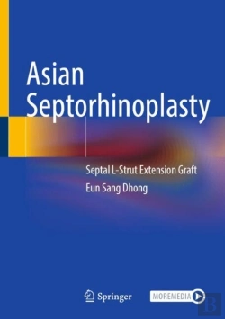 Bertrand.pt - Asian Septorhinoplasty