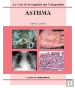 Bertrand.pt - Asthma