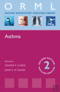 Bertrand.pt - Asthma