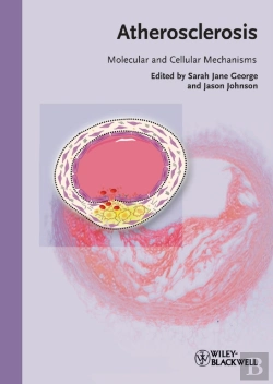 Bertrand.pt - Atherosclerosis