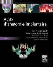 Atlas D'Anatomie Implantaire (2e Édition)