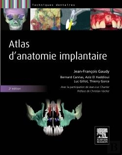Bertrand.pt - Atlas D'Anatomie Implantaire (2e Édition)