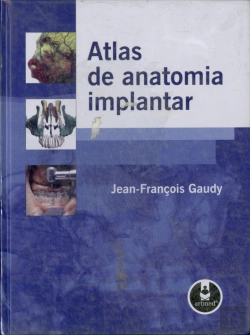 Bertrand.pt - Atlas de Anatomia Implantar