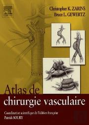 Atlas De Chirurgie Vasculaire