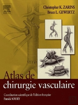Bertrand.pt - Atlas De Chirurgie Vasculaire
