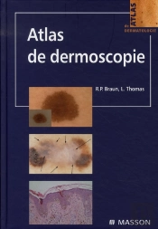 Atlas De Dermoscopie