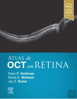 Bertrand.pt - Atlas de OCT em Retina