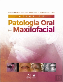 Bertrand.pt - Atlas de Patologia Oral e Maxilofacial