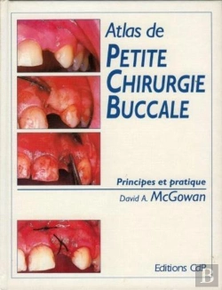 Bertrand.pt - Atlas De Petite Chirurgie Buccale ; Principes Et Pratique