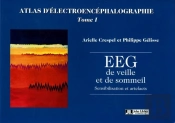 Atlas D'Electroencephalographie Tome1 Eeg De Veille Et De   Sommeil