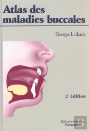 Atlas Des Maladies Buccales