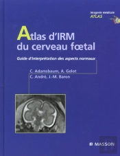 Atlas D'Irm Du Cerveau Foetal ; Guide D'Interpretation Des Aspects Normaux