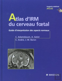 Bertrand.pt - Atlas D'Irm Du Cerveau Foetal ; Guide D'Interpretation Des Aspects Normaux