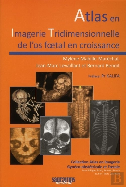 Bertrand.pt - Atlas En Imagerie Tridimensionneelle De L'Os Foetal En Croissance