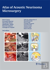 Atlas Of Acoustic Neurinoma Microsurgery