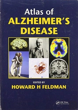 Bertrand.pt - Atlas Of Alzheimer'S Disease