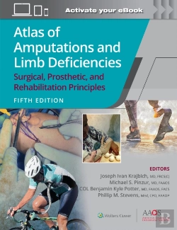 Bertrand.pt - Atlas Of Amputations And Limb Deficiencies 5