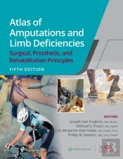 Atlas Of Amputations And Limb Deficiencies
