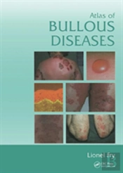 Atlas Of Bullous Diseases