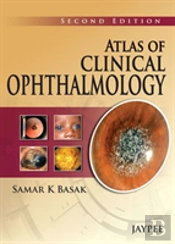 Atlas Of Clinical Ophthalmology