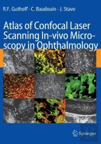 Atlas Of Confocal Laser Scanning In-Vivo Microscopy In Ophthalmology