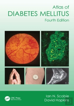Bertrand.pt - Atlas Of Diabetes Mellitus