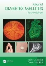 Atlas Of Diabetes Mellitus