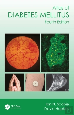 Bertrand.pt - Atlas Of Diabetes Mellitus