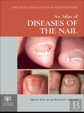 Atlas Of Diseases Of The Nail