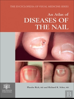 Bertrand.pt - Atlas Of Diseases Of The Nail