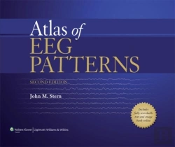 Bertrand.pt - Atlas Of Eeg Patterns
