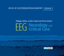 Bertrand.pt - Atlas Of Electroencephalography Volume 3