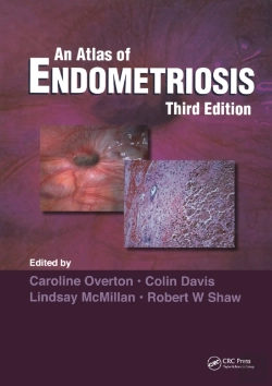 Bertrand.pt - Atlas Of Endometriosis